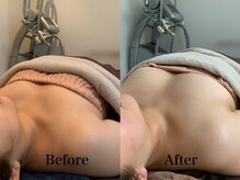 ジェイオー(J.O)/バストアップコルギ/小顔コルギ