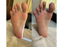 サロン サルー(SALON Salud)/◇足つぼ×調整