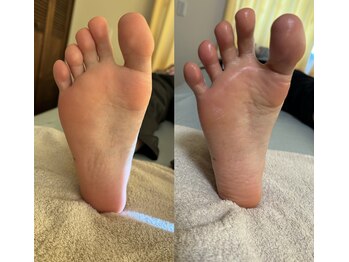 サロン サルー(SALON Salud)/◇足つぼ×調整