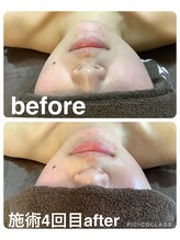 ギンザアール(GINZA R.)/小顔マッサージ◎