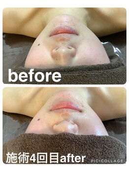 ギンザアール(GINZA R.)/小顔マッサージ◎