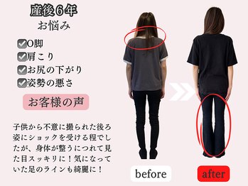 アオラド(Aolado)/【３０代】産後6年8回目終了