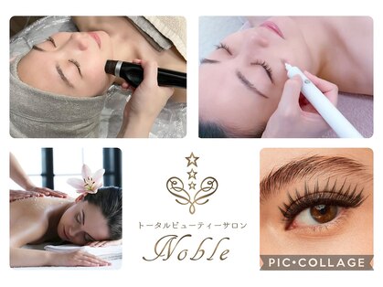 ノーブル(Noble)の写真