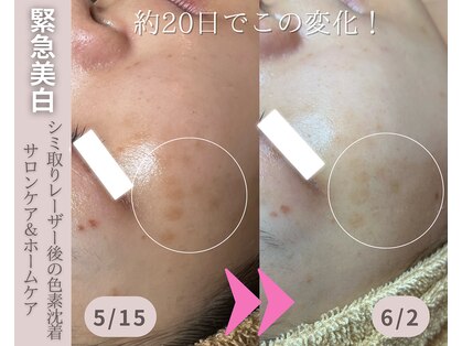 シストワ(sistoi)の写真