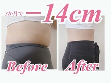 ラヴ 久屋大通店(Luv)/やよい様BeforeAfter