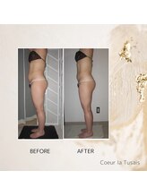 クーラ テュセ(Coeur la Tusais)/【40歳以上】全身まるごと痩身