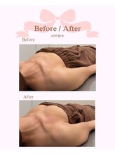 ロココ 安城店(Rococo)/バストアップ症例