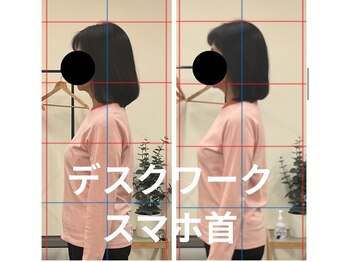 カワル整体 長嶺院/スマホ首・デスクワーク