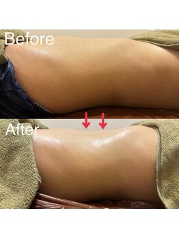 ウェルース(Velus)/くびれの作り方