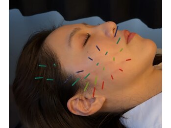 アロエベル(aloe Belle)/美容鍼