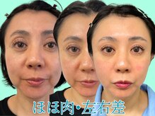 ナチュラルパーフェクトフェイス 新宿