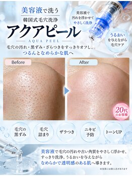 ホープリテーラー 日進店(HOPE Retailer)の写真/【日進にNEWOPEN】韓国で定番の肌管理法が日進にも登場★毛穴・黒ずみ・くすみ・ニキビに!アクアピール◎