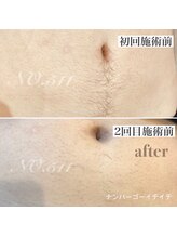 ナンバー511(No.511)/1回での効果