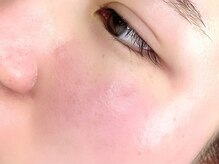 マム 錦糸町店(ma’am)/フェイシャルワックス　ma'am