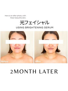 ハグミー 甲子園口(HUGME.)/若見え/小顔/トーンアップ/美肌