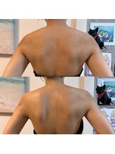 ビューティサロン ポノ(Pono)/ブライダル前の肩甲骨美人