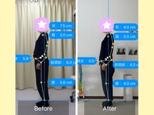 ナオル整体 大宮院(NAORU整体)/首肩こりが減り、姿勢が改善！