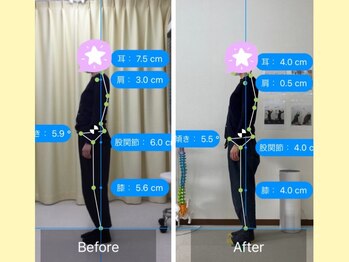 ナオル整体 大宮院(NAORU整体)/首肩こりが減り、姿勢が改善！