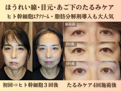 ルマ(Rumah)の写真