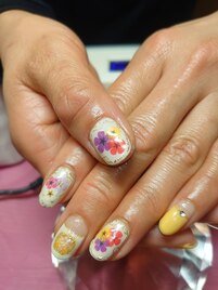定額制カルジェル2025-4