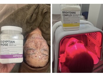 シャンディ(Shandy)/ハイドロジェリーマスク&LED☆