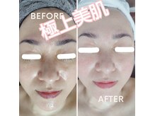 ビキャン(Can)の雰囲気（【うる艶肌実感】美白/ツヤ/透明感　自信に満ちた肌を手に入れる）