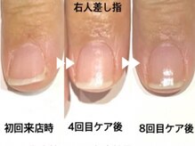 ブリエネイルの雰囲気（50代/女性/公務員/施術の効果には個人差があります）