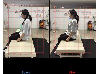 ストレチックス 近江八幡店/肩こり改善ビフォーアフター1回