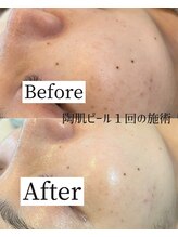 ワイシーハッチ(yc.hacci) 新ＭＥＮＵ 陶肌ピール