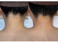 ミミ(MIMI)/お好みのうなじ作れます♪