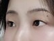 リライン(Re line)の写真/憧れのぱっちりEYEに♪どんなお悩みも解消し、納得の仕上がりをお約束します◎