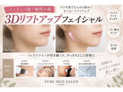ピュアスキンサロン 恵比寿店(pure skin salon)の写真