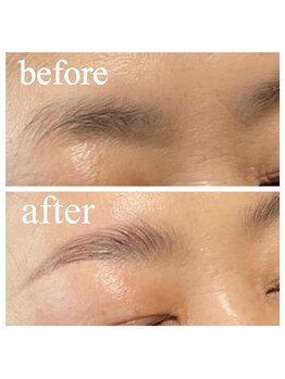 ブリリアント(brilliant)/ハリウッドブロウリフト