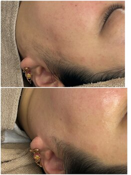 リノ(Lino)/もみあげスッキリ☆