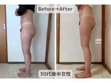 ピーチ(Peach)/骨盤矯正×ダイエット×美尻