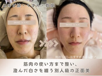 ビカオ(BIKAO)/ヒト幹細胞ハーブ(再生・維持)