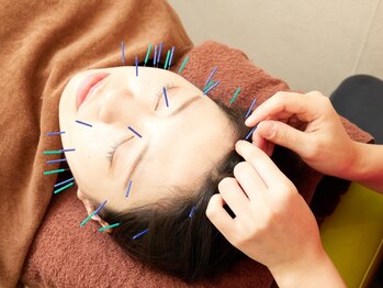 谷町はら鍼灸整骨院の写真/【Rehari式美容鍼50分¥4600】谷町六丁目駅すぐ!!初めての方も大歓迎☆内側も外側も綺麗になりませんか？