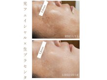 リブラン(Libran)の雰囲気（40代からの本気のシミケアをスタートしてみませんか？）