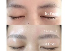 アオ(Ao)/【ハリウッドブロウリフト】