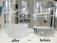 ロココ(LOCOCO)/毛穴洗浄ビフォーアフター