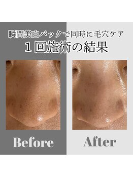 カフネ(CAFUNE.)/瞬間美白パックで同時に毛穴ケア