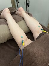 ハリマジック 代官山(HARI MAGIC)/【代官山/鍼灸/美容鍼】