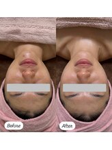 ソルティ サロン(salty salon)/当店人気No.1コース