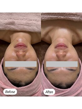 ソルティ サロン(salty salon)/当店人気No.1コース