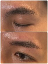 スリーピース(3Peace)/Before/After