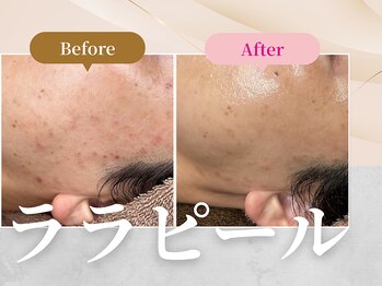 フェルナ 上新庄店(FERNA)/ララピール