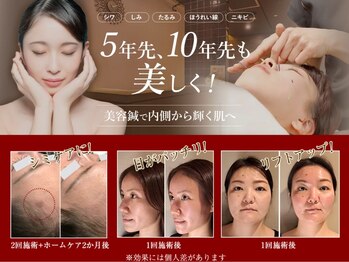 ラ コンシェル 青葉台店