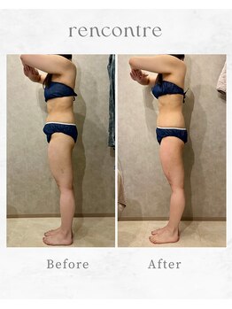 ランコント(rencontre)/肩こり/リンパ/ヘッドスパ/痩身