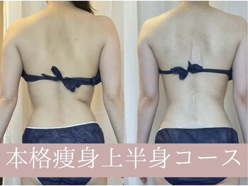 レイアス(Ray as)/背中の癖にも効果的◎