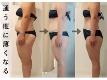 ビューティーグランツ(beauty granz)/通う度に変化を実感！